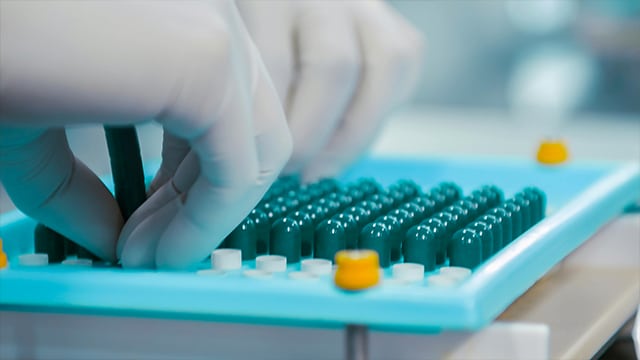 Someone wearing latex gloves organising pills in a tray